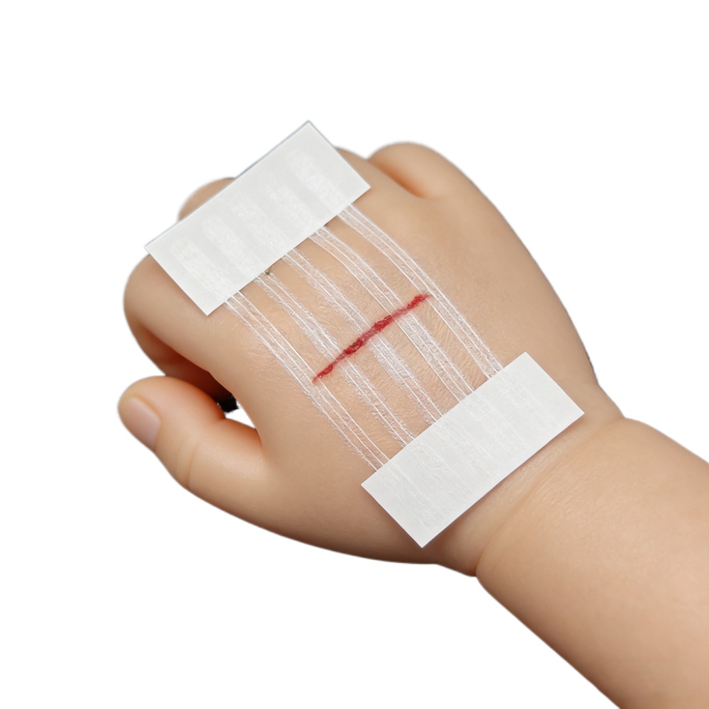 Medical Label - 5 Şerit Yara Cilt Kapatma Şeritleri