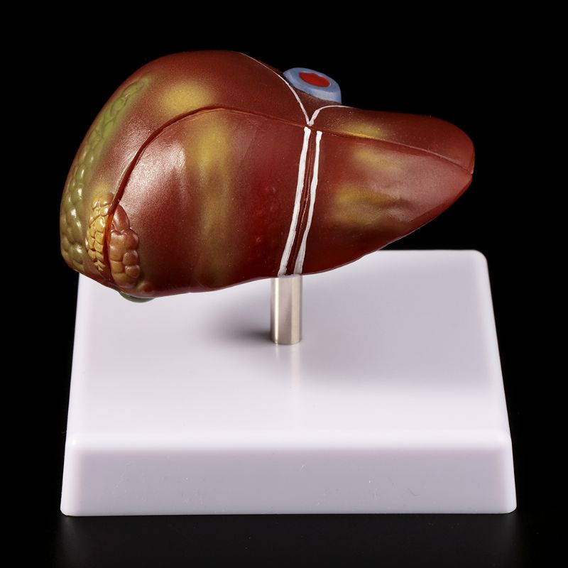 Insan Karaciğer Patolojik Anat - Medical Lab Technology incelemesi ve fiyatı