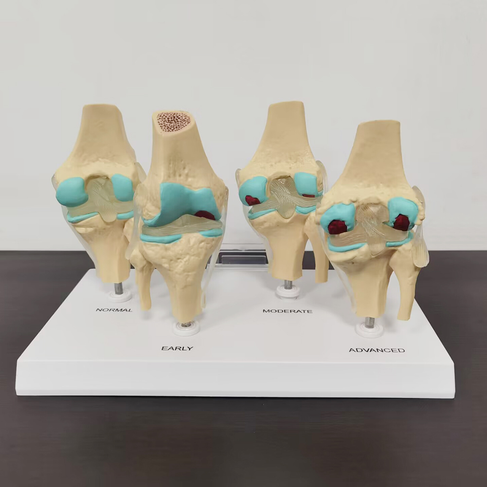 4-stage diz eklem modeli plast - Medical Lab Technology incelemesi ve fiyatı