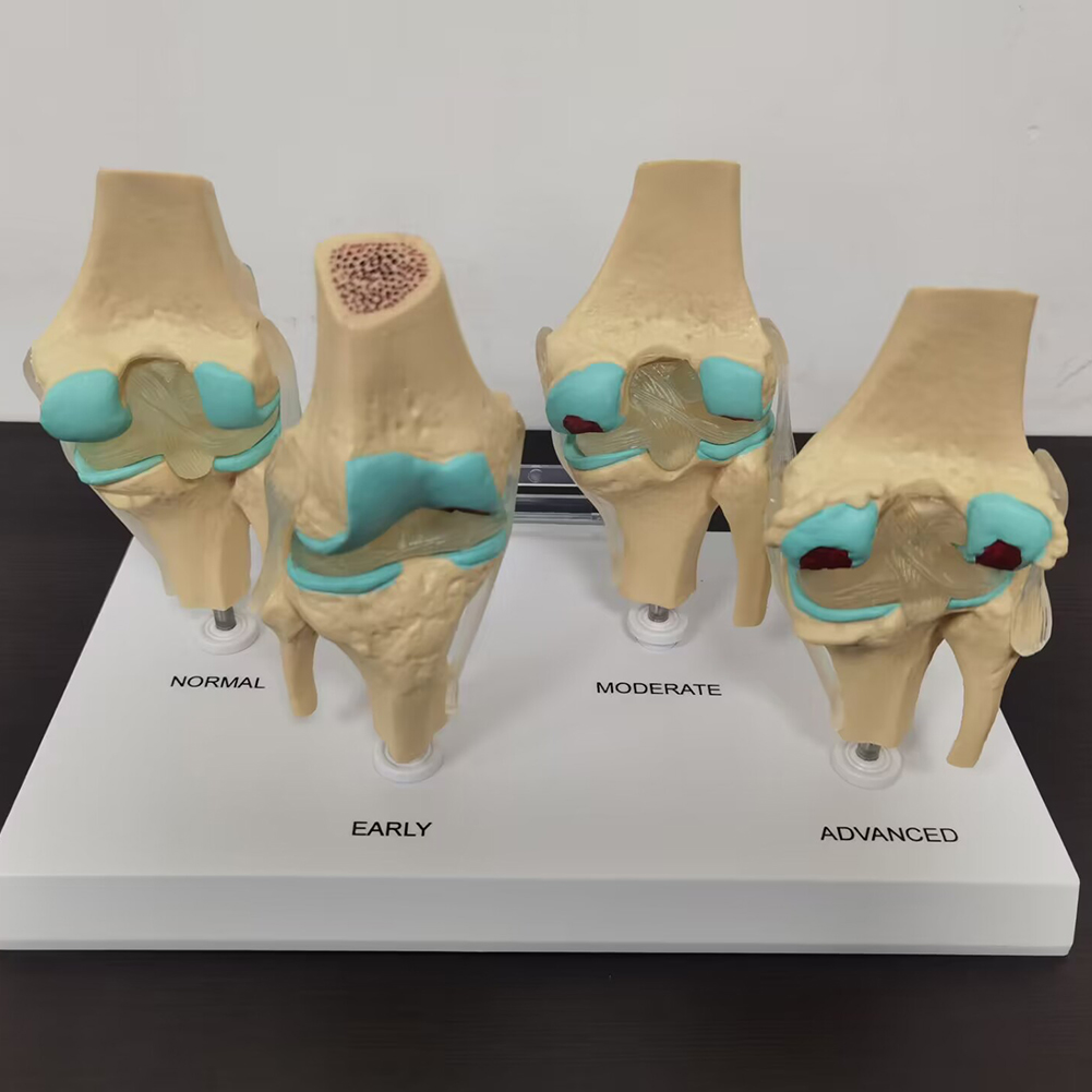 4-stage diz eklem modeli plast - Medical Lab Technology incelemesi ve fiyatı