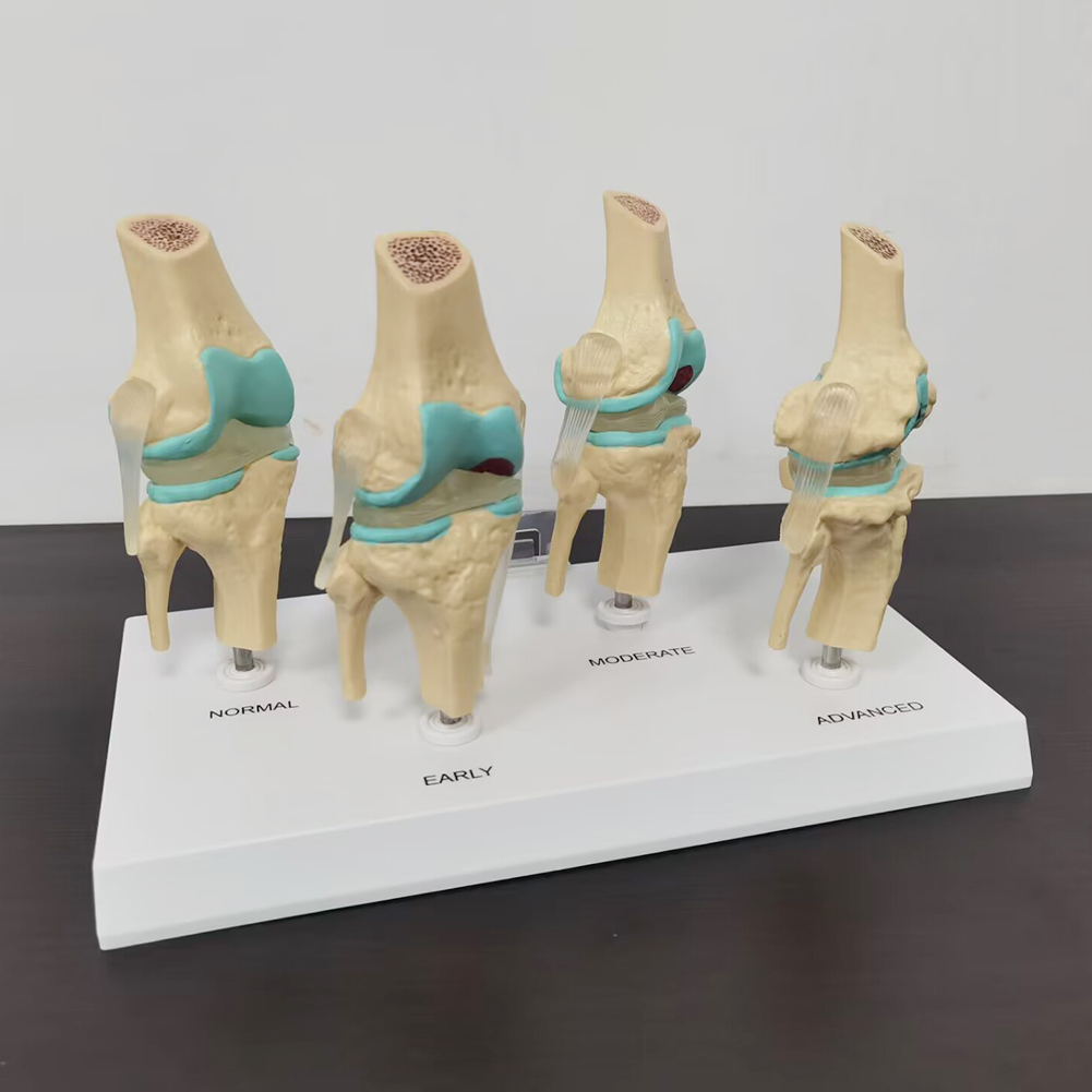 4-stage diz eklem modeli plast - Medical Lab Technology incelemesi ve fiyatı